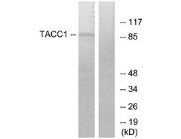 Anti-TACC1, N-Terminal antibody produced in rabbit~1 mg/mL, affinity isolated antibody, buffered aqueous solution