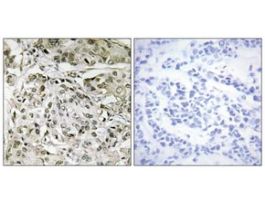 Anti-TAF1 antibody produced in rabbit~1 mg/mL, affinity isolated antibody, buffered aqueous solution