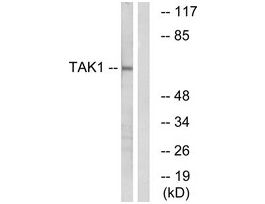 Anti-TAK1 antibody produced in rabbit~1 mg/mL, affinity isolated antibody, buffered aqueous solution