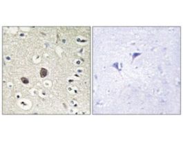 Anti-TIE2, C-Terminal antibody produced in rabbit~1 mg/mL, affinity isolated antibody, buffered aqueous solution