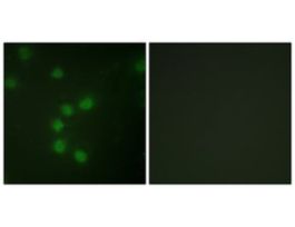 Anti-Telomerase antibody produced in rabbit~1 mg/mL, affinity isolated antibody, buffered aqueous solution