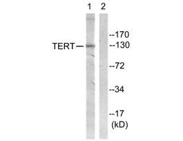 Anti-Telomerase antibody produced in rabbit~1 mg/mL, affinity isolated antibody, buffered aqueous solution