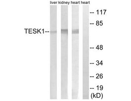 Anti-TESK1 antibody produced in rabbit~1 mg/mL, affinity isolated antibody, buffered aqueous solution