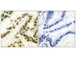 Anti-AP-2, C-Terminal antibody produced in rabbit~1 mg/mL, affinity isolated antibody, buffered aqueous solution