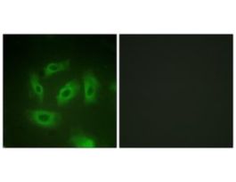 Anti-TGF beta Receptor I antibody produced in rabbit~1 mg/mL, affinity isolated antibody, buffered aqueous solution