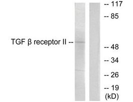 Anti-TGF beta Receptor II antibody produced in rabbit~1 mg/mL, affinity isolated antibody, buffered aqueous solution