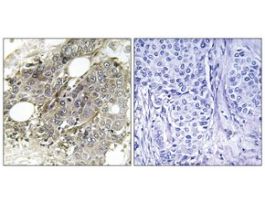 Anti-TGF beta Receptor III, C-Terminal antibody produced in rabbit~1 mg/mL, affinity isolated antibody, buffered aqueous solution