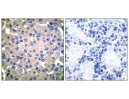 Anti-Transglutaminase 2, N-Terminal antibody produced in rabbit~1 mg/mL, affinity isolated antibody, buffered aqueous solution