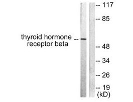 Anti-Thyroid Hormone Receptor beta, N-Terminal antibody produced in rabbit~1 mg/mL, affinity isolated antibody, buffered aqueous solution