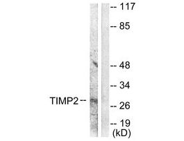 Anti-TIMP2 antibody produced in rabbit~1 mg/mL, affinity isolated antibody, buffered aqueous solution