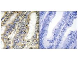 Anti-TNFA antibody produced in rabbit~1 mg/mL, affinity isolated antibody, buffered aqueous solution
