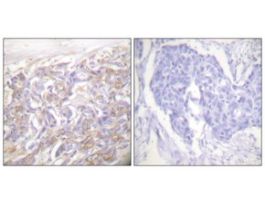Anti-TNF Receptor I, C-Terminal antibody produced in rabbit~1 mg/mL, affinity isolated antibody, buffered aqueous solution