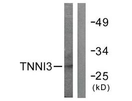 Anti-TNNI3 antibody produced in rabbit~1 mg/mL, affinity isolated antibody, buffered aqueous solution