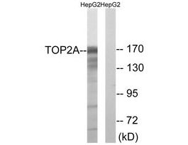 Anti-TOP2A, C-Terminal antibody produced in rabbit~1 mg/mL, affinity isolated antibody, buffered aqueous solution
