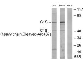 Anti-C1S (heavy chain, Cleaved-Arg437) antibody produced in rabbit~1 mg/mL, affinity isolated antibody, buffered aqueous solution