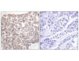 Anti-Tubulin gamma, C-Terminal antibody produced in rabbit~1 mg/mL, affinity isolated antibody, buffered aqueous solution