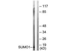 Anti-SUMO1, N-Terminal antibody produced in rabbit~1 mg/mL, affinity isolated antibody, buffered aqueous solution