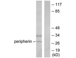Anti-PGP9.5, C-Terminal antibody produced in rabbit~1 mg/mL, affinity isolated antibody, buffered aqueous solution