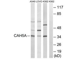 Anti-CA5A antibody produced in rabbit~1 mg/mL, affinity isolated antibody, buffered aqueous solution