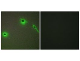 Anti-Collagen XVIII alpha1 antibody produced in rabbit~1 mg/mL, affinity isolated antibody, buffered aqueous solution