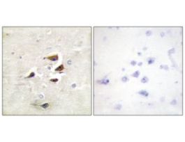 Anti-CAMK2 antibody produced in rabbit~1 mg/mL, affinity isolated antibody, buffered aqueous solution