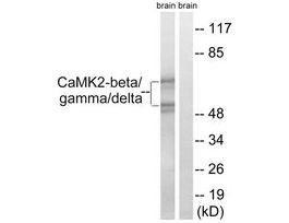 Anti-CAMK2 antibody produced in rabbit~1 mg/mL, affinity isolated antibody, buffered aqueous solution