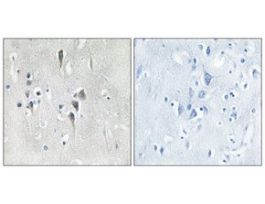 Anti-CAMK2 antibody produced in rabbit~1 mg/mL, affinity isolated antibody, buffered aqueous solution
