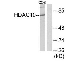Anti-HDAC10, N-Terminal antibody produced in rabbit~1 mg/mL, affinity isolated antibody, buffered aqueous solution