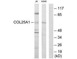 Anti-Collagen XXV alpha1 antibody produced in rabbit~1 mg/mL, affinity isolated antibody, buffered aqueous solution