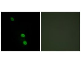 Anti-TEAD2 antibody produced in rabbit~1 mg/mL, affinity isolated antibody, buffered aqueous solution