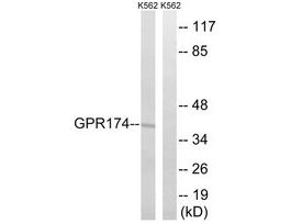 Anti-GPR174 antibody produced in rabbit~1 mg/mL, affinity isolated antibody, buffered aqueous solution