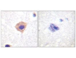 Anti-Catalase antibody produced in rabbit~1 mg/mL, affinity isolated antibody, buffered aqueous solution
