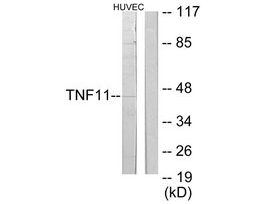 Anti-TNFSF11 antibody produced in rabbit~1 mg/mL, affinity isolated antibody, buffered aqueous solution