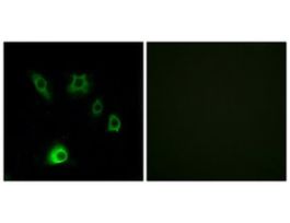 Anti-FGF18, C-Terminal antibody produced in rabbit~1 mg/mL, affinity isolated antibody, buffered aqueous solution