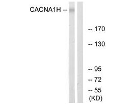 Anti-CACNA1H antibody produced in rabbit~1 mg/mL, affinity isolated antibody, buffered aqueous solution