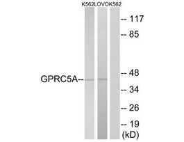Anti-GPRC5A antibody produced in rabbit~1 mg/mL, affinity isolated antibody, buffered aqueous solution