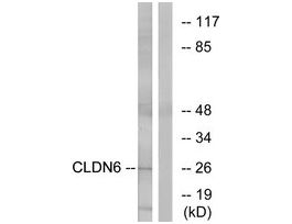 Anti-CLDN6 antibody produced in rabbit~1 mg/mL, affinity isolated antibody, buffered aqueous solution