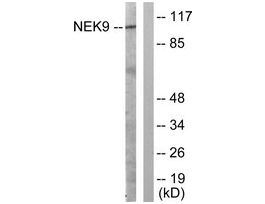 Anti-NEK9 antibody produced in rabbit~1 mg/mL, affinity isolated antibody, buffered aqueous solution