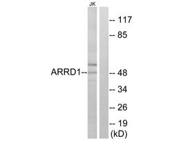 Anti-ARRD1 antibody produced in rabbit~1 mg/mL, affinity isolated antibody, buffered aqueous solution