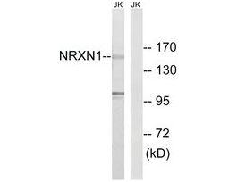 Anti-NRXN1 antibody produced in rabbit~1 mg/mL, affinity isolated antibody, buffered aqueous solution
