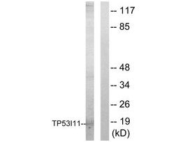 Anti-TP53I11 antibody produced in rabbit~1 mg/mL, affinity isolated antibody, buffered aqueous solution
