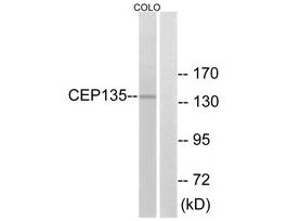 Anti-CEP135, C-Terminal antibody produced in rabbit~1 mg/mL, affinity isolated antibody, buffered aqueous solution