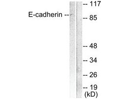 Anti-E-cadherin, N-Terminal antibody produced in rabbit~1 mg/mL, affinity isolated antibody, buffered aqueous solution