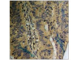 Anti-phospho-EGFR (pThr693) antibody produced in rabbit~1 mg/mL, affinity isolated antibody, buffered aqueous solution