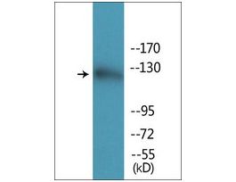 Anti-phospho-Abl (pTyr412) antibody produced in rabbit~1 mg/mL, affinity isolated antibody, buffered aqueous solution