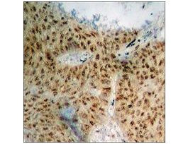 Anti-phospho-ACC1 (pSer80) antibody produced in rabbit~1 mg/mL, affinity isolated antibody, buffered aqueous solution