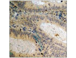 Anti-phospho-Csk (pSer364) antibody produced in rabbit~1 mg/mL, affinity isolated antibody, buffered aqueous solution