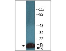 Anti-phospho-CD3 zeta (pTyr142) antibody produced in rabbit~1 mg/mL, affinity isolated antibody, buffered aqueous solution