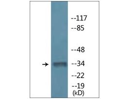 Anti-phospho-MYOD (pSer200) antibody produced in rabbit~1 mg/mL, affinity isolated antibody, buffered aqueous solution