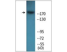 Anti-phospho-ALK (pTyr1604) antibody produced in rabbit~1 mg/mL, affinity isolated antibody, buffered aqueous solution